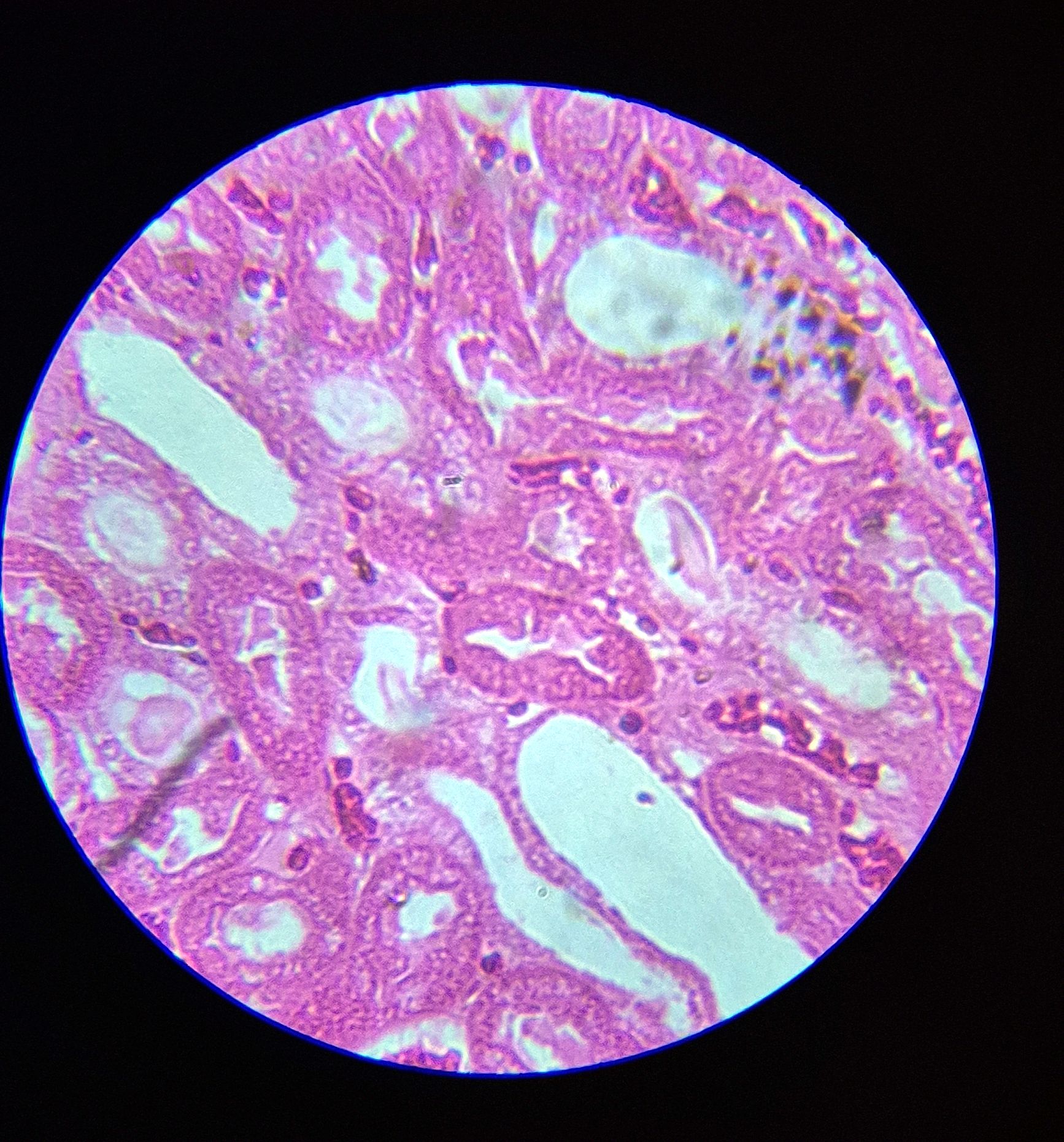 no-87-rein-l-s-kidney-of-l-s